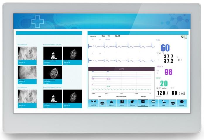 ADLINK MLC 5-21HE Medical AIO i7-5700EQ/8GB/128GB SSD *TouchScreen* *No Stand*