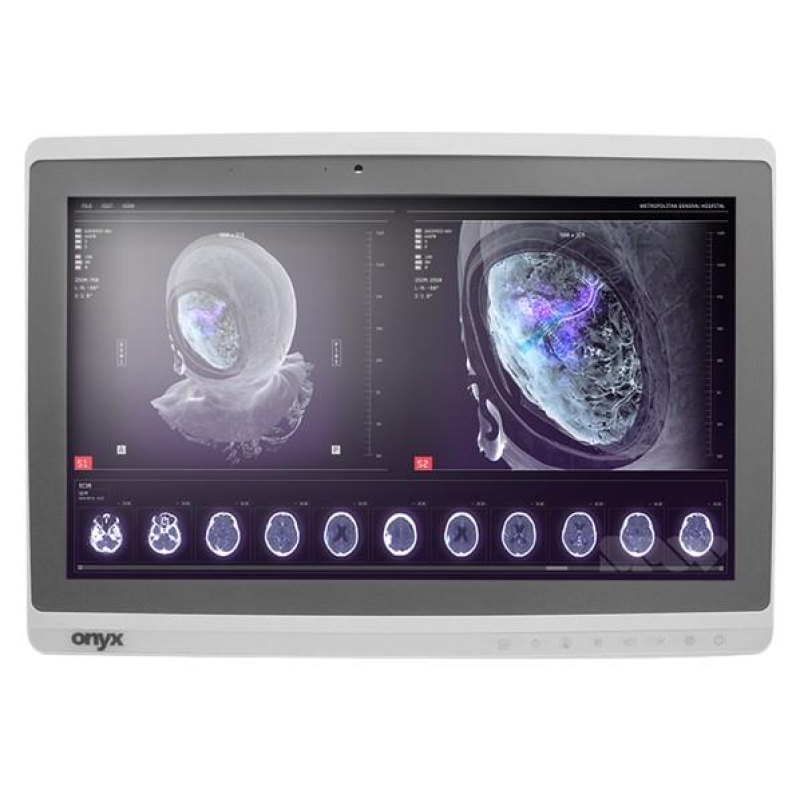 Onyx-Zeus-248 Professional Medical AIO i7-6600U/8GB/250GB SSD *TouchScreen* *No Stand*
